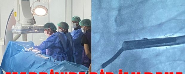 Kırık kalp pili kablosu ameliyatla çıkarıldı